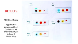 Blood Typing.pptx