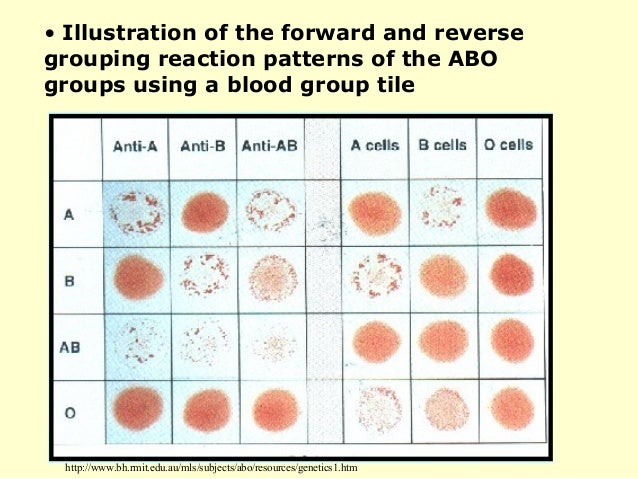 Blood Group Identification Chart