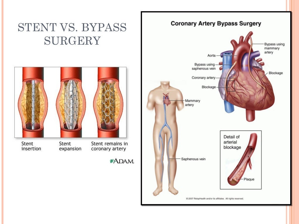 Anatomy & Physiology Lecture Notes - Blood vessels & circulation