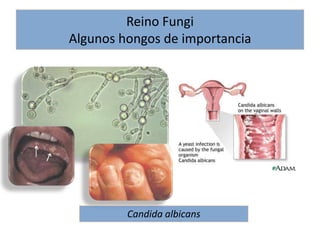 Candida albicansReino FungiAlgunos hongos de importancia