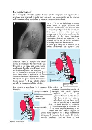 Proyección Lateral
     En la radiografía lateral las sombras hiliares derecha e izquierda está superpuestas y
     producen una opacidad ovalada que representa una combinación de las arterias
     pulmonares derecha e izquierda y de las venas pulmonares superiores.

                                                 En el 97% de los individuos normales
                                                 puede verse la pared posterior del
                                                 bronquio intermediario que continua con
                                                 la pared traqueal posterior. Por delante de
                                                 éste aparece una sombra oval que
                                                 corresponde a la arteria interlobar. La
                                                 confluencia de las venas superiores
                                                 pulmonares derechas se superpone a la
                                                 porción inferior de la arteria pulmonar
                                                 derecha y contribuye a su densidad.
                                                 A veces, por debajo de la densidad de la
                                                 arteria interlobular se reconoce una




                                                                                    Areria
                                                                                    pulmonar
     estructura aérea: el bronquio del lóbulo      Vasos                            izquierda
     medio. Normalmente la parte visible del       pulmonares
                                                   derechos
     bronquio es su pared que aparece como
     una línea de densidad agua. Cuando en vez
     de densidades lineales los bronquios
     se ven como broncogramas aéreos Bronquio del LM
     debe sospecharse la existencia de
     adenopatías hiliares, subcarinales o ambas.
     El espacio que queda entre el bronquio del
                                                   Bronquio del LID
     lóbulo medio y el del lóbulo inferior
     derecho se llama ventana hiliar inferior.
                                                                        Bronquio del LII

     Las estructuras vasculares de la densidad hiliar rodean los
     bronquios                                        centrales. Empezando por arriba, el
                               Bronquio del LSD       bronquio del lóbulo superior
                                                        derecho       se      ve      en
                                Bronquio                aproximadamente el 50% de los
                                intermediario           individuos como una lucencia
                                                        redondeada vista de frente en el
                                                        margen superior de la densidad
                                                hiliar. La pared posterior del bronquio
                                                      intermediario (que se continúa con
                               Bronquio del LSI
                                                      la pared traqueal posterior) se ve
                                                 como una línea vertical delgada de
                                       2mm o menos de grosor que se dirige caudalmente
                                       dividiendo la lucencia del bronquio del lóbulo
                                       superior izquierdo visto de frente en una

Ventana hiliar inferior
 