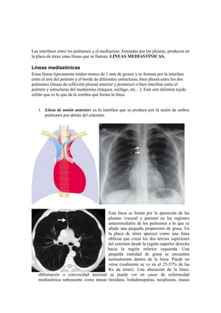 Las interfases entre los pulmones y el mediastino, formadas por las pleuras, producen en
la placa de tórax unas líneas que se llaman: LÍNEAS MEDIASTÍNICAS.

Líneas mediastínicas
Estas líneas típicamente miden menos de 1 mm de grosor y se forman por la interfase
entre el aire del pulmón y el borde de diferentes estructuras, bien pleura entre los dos
pulmones (lineas de reflexión pleural anterior y posterior) o bien interfase entre el
pulmón y estructuras del mediastino (tráquea, esófago, etc…). Este aire delimita tejido
sólido que es lo que da la sombra que forma la línea.


   1. Línea de unión anterior: es la interfase que se produce por la unión de ambos
      pulmones por detrás del esternón.




                                      Esta línea se forma por la aposición de las
                                      pleuras visceral y parietal en las regiones
                                      anteromediales de los pulmones a lo que se
                                      añade una pequeña proporción de grasa. En
                                      la placa de tórax aparece como una línea
                                      oblícua que cruza los dos tercios superiores
                                      del esternón desde la región superior derecha
                                      hacia la región inferior izquierda. Una
                                      pequeña cantidad de grasa se encuentra
                                      normalmente dentro de la línea. Puede no
                                      verse (realmente se ve en el 25-57% de las
                                      Rx de tórax). Una alteración de la línea:
   obliteración o convexidad anormal se puede ver en casos de enfermedad
   mediastínica subyacente como masas tiroideas, linfadenopatías, neoplasias, masas
 