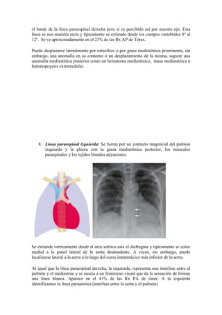 el borde de la línea paraespinal derecha pero sí es percibido así por nuestro ojo. Esta
línea se nos muestra recta y típicamente se extiende desde los cuerpos vertebrales 8º al
12º. Se ve aproximadamente en el 23% de las Rx AP de Tórax.

Puede desplazarse lateralmente por osteofitos o por grasa mediastínica prominente, sin
embargo, una anomalía en su contorno o un desplazamiento de la misma, sugiere una
anomalía mediastínica posterior como un hematoma mediastínico, masa mediastínica o
hematopoyesis extramedular.




   8. Línea paraespinal izquierda: Se forma por un contacto tangencial del pulmón
      izquierdo y la pleura con la grasa mediastínica posterior, los músculos
      paraspinales y los tejidos blandos adyacentes.




Se extiende verticamente desde el arco aórtico asta el diafragma y típicamente se coloc
medial a la pared lateral de la aorta desdendente. A veces, sin embargo, puede
localizarse lateral a la aorta a lo largo del curso intratorácico más inferior de la aorta.

Al igual que la línea paraespinal derecha, la izquierda, representa una interfase entre el
pulmón y el mediastino y se asocia a un fenómeno visual que da la sensación de formar
una línea blanca. Aparece en el 41% de las Rx PA de tórax. A la izquierda
identificamos la línea paraaórtica (interfase entre la aorta y el pulmón)
 