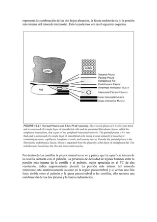 representa la combinación de las dos hojas pleurales, la fascia endotorácica y la porción
más interna del músculo intercostal. Esto lo podemos ver en el siguiente esquema.




Por dentro de las costillas la pleura normal no se ve y parece que la superficie interna de
la costilla contacta con el pulmón. La presencia de densidad de tejidos blandos entre la
porción más interna de la costilla y el pulmón, mejor apreciada en el TC de alta
resolución, indica engrosamiento pleural. La porción más interna del músculo
intercostal está anatómicamente ausente en la región paravertebral y si vemos una fina
línea visible entre el pulmón y la grasa paravertebral o las costillas, ello rereseta una
combinación de las dos pleuras y la fascia endotorácica.
 