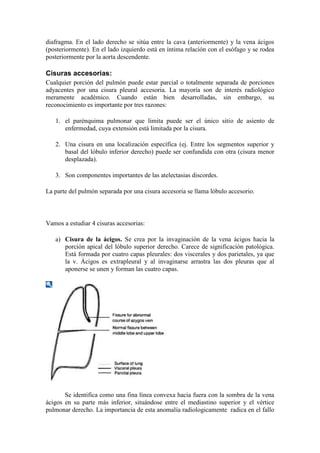 diafragma. En el lado derecho se sitúa entre la cava (anteriormente) y la vena ácigos
(posteriormente). En el lado izquierdo está en íntima relación con el esófago y se rodea
posteriormente por la aorta descendente.

Cisuras accesorias:
Cualquier porción del pulmón puede estar parcial o totalmente separada de porciones
adyacentes por una cisura pleural accesoria. La mayoría son de interés radiológico
meramente académico. Cuando están bien desarrolladas, sin embargo, su
reconocimiento es importante por tres razones:

   1. el parénquima pulmonar que limita puede ser el único sitio de asiento de
      enfermedad, cuya extensión está limitada por la cisura.

   2. Una cisura en una localización específica (ej. Entre los segmentos superior y
      basal del lóbulo inferior derecho) puede ser confundida con otra (cisura menor
      desplazada).

   3. Son componentes importantes de las atelectasias discordes.

La parte del pulmón separada por una cisura accesoria se llama lóbulo accesorio.



Vamos a estudiar 4 cisuras accesorias:

   a) Cisura de la ácigos. Se crea por la invaginación de la vena ácigos hacia la
      porción apical del lóbulo superior derecho. Carece de significación patológica.
      Está formada por cuatro capas pleurales: dos viscerales y dos parietales, ya que
      la v. Ácigos es extrapleural y al invaginarse arrastra las dos pleuras que al
      aponerse se unen y forman las cuatro capas.




       Se identifica como una fina línea convexa hacia fuera con la sombra de la vena
ácigos en su parte más inferior, situándose entre el mediastino superior y el vértice
pulmonar derecho. La importancia de esta anomalía radiologicamente radica en el fallo
 