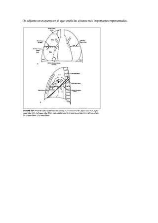 Os adjunto un esquema en el que tenéis las cisuras más importantes representadas.
 