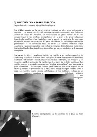D) ANATOMÍA DE LA PARED TORÁCICA
La pared torácica consta de tejidos blandos y huesos.

Los tejidos blandos de la pared torácica consisten en piel, grasa subcutánea y
músculos. Los bordes laterales del músculo esternocleidomastoideo son fácilmente
visibles en todos los pacientes. La visualización de grasa normal en la fosa
supraclavicular y las sombras acompañantes de la piel y la grasa subcutánea
discurriendo paralelas a las clavículas ayuda a excluir la existencia de una masa,
adenopatías o edema en esta región. El borde inferolateral del músculo pectoral mayor
generalmente se ve curvándose hacia las axilas. Las sombras mamarias deben
visualizarse y evaluarse de rutina para excluir la existencia de mastectomía o una masa.
Los tejidos blandos laterales al torax óseo deben ser suaves, simétricos y de densidad
homogénea.

Los huesos del tórax. La columna torácia, las costillas y los cartílagos costales, las
clavículas y la escápula se ven de rutina en la placa de tórax. Los cuerpos de la columna
se alinean verticalmente visualizándose los platillos vertebrales, los pedículos y los
procesos o apófisis espinosas. Se pueden ver doce pares de costillas simétricas. Las
costillas primera y segunda muestran una “sombra acompañante” que representa la
grasa extrapleural. Los cartílagos costales calcificados se ven en la mayoría de los
adultos y aumenta su prevalencia con la edad, dando a veces múltiples sombras sobre el
tórax. Los hombres suelen mostral calcificación de los cartílagos costales en los
             márgenes superiores e                                  inferiores,     mientras
              que     las      mujeres                              muestran             una
                        calcificación                                          cartilaginosa
central.




                        Sombras acompañantes de las costillas en la placa de torax
                        (flechas).
 