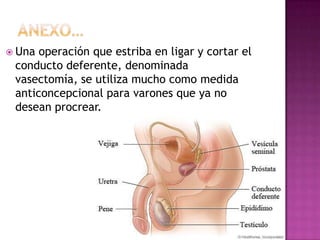 Anexo…Una operación que estriba en ligar y cortar el conducto deferente, denominada vasectomía, se utiliza mucho como medida anticoncepcional para varones que ya no desean procrear.