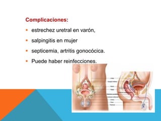 Complicaciones:
 estrechez uretral en varón,
 salpingitis en mujer
 septicemia, artritis gonocócica.
 Puede haber reinfecciones.
 