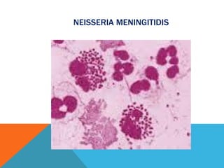 NEISSERIA MENINGITIDIS
 