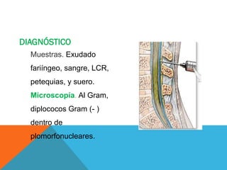 DIAGNÓSTICO
Muestras. Exudado
fariíngeo, sangre, LCR,
petequias, y suero.
Microscopía. Al Gram,
diplococos Gram (- )
dentro de
plomorfonucleares.
 