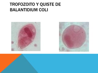 TROFOZOITO Y QUISTE DE
BALANTIDIUM COLI
 