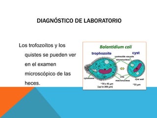 DIAGNÓSTICO DE LABORATORIO
Los trofozoítos y los
quistes se pueden ver
en el examen
microscópico de las
heces.
 