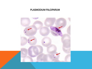 PLASMODIUM FALCIPARUM
 
