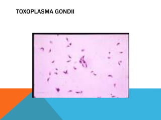 TOXOPLASMA GONDII
 