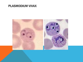 PLASMODIUM VIVAX
 