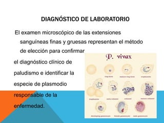 DIAGNÓSTICO DE LABORATORIO
El examen microscópico de las extensiones
sanguíneas finas y gruesas representan el método
de elección para confirmar
el diagnóstico clínico de
paludismo e identificar la
especie de plasmodio
responsable de la
enfermedad.
 