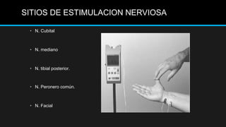 • N. Cubital
• N. mediano
• N. tibial posterior.
• N. Peronero común.
• N. Facial
SITIOS DE ESTIMULACION NERVIOSA
 