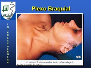 Plexo Braquial

I
N
T
E
R
E
S
C
A
L
E
N
I
C
A
 