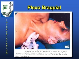 Plexo Braquial

I
N
T
E
R
E
S
C
A
L
E
N
I
C
A
 