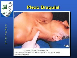 Plexo Braquial


S
U
B
C
L
A
V
I
A
 