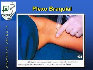 Plexo Braquial

B
L
O
Q
U
EI
O
A
C
E
S
S
O
RI
O
 