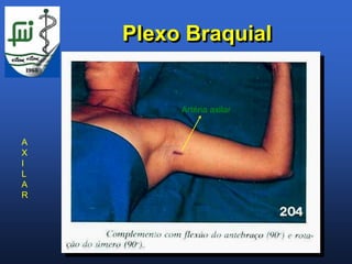 Plexo Braquial


         Artéria axilar


A
X
I
L
A
R
 