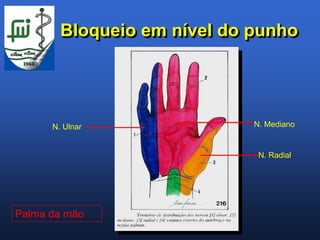 Bloqueio em nível do punho




      N. Ulnar               N. Mediano


                              N. Radial




Palma da mão
 