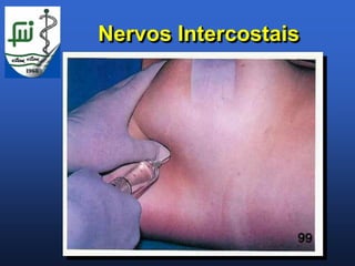 Nervos Intercostais
 