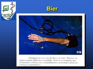 Bier
 