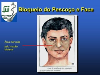 Bloqueio do Pescoço e Face




Área inervada
pelo maxilar
bilateral
 