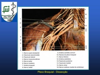 Plexo Braquial - Dissecção
 
