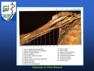 Dissecção do Plexo Braquial
 
