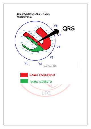 Bloqueios de ramo final
