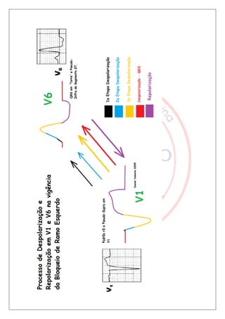 Bloqueios de ramo final