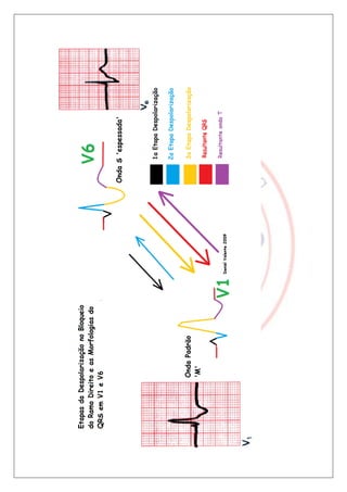 Bloqueios de ramo final