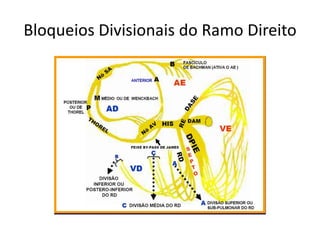 Bloqueios Divisionais do Ramo Direito
 