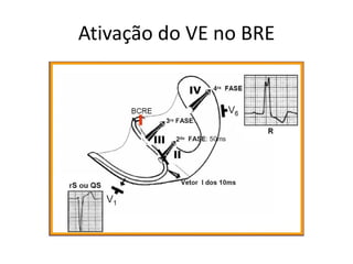 Ativação do VE no BRE
 