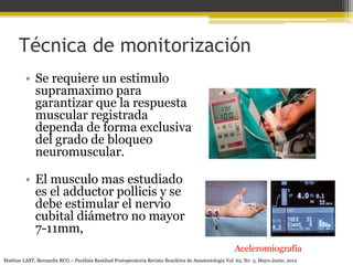 Técnica de monitorización 
• Se requiere un estimulo 
supramaximo para 
garantizar que la respuesta 
muscular registrada 
dependa de forma exclusiva 
del grado de bloqueo 
neuromuscular. 
• El musculo mas estudiado 
es el adductor pollicis y se 
debe estimular el nervio 
cubital diámetro no mayor 
7-11mm, 
Aceleromiografia 
Mathias LAST, Bernardis RCG – Parálisis Residual Postoperatoria Revista Brasileira de Anestesiologia Vol. 62, No 3, Mayo-Junio, 2012 
 