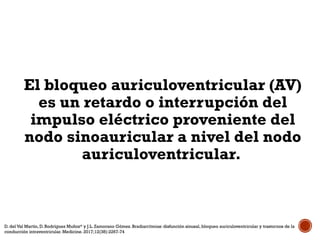 Clase bloqueo auriculo ventriculares. ppt | PPTX