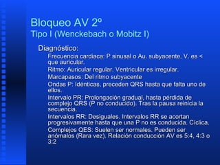 Bloqueo aurículo ventricular | PPT