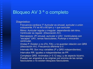 Bloqueo aurículo ventricular | PPT