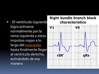 Bloqueo auriculo ventricular | PPTX