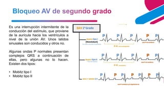 5
Es una interrupción intermitente de la
conducción del estímulo, que proviene
de la aurícula hacia los ventrículos a
nivel de la unión AV. Unos latidos
sinusales son conducidos y otros no.
Algunas ondas P normales presentan
complejos QRS a continuación de
ellas, pero algunas no lo hacen.
Existen dos tipos:
• Mobitz tipo I
• Mobitz tipo II
 