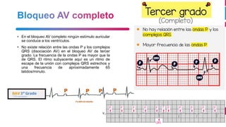 9
• En el bloqueo AV completo ningún estímulo auricular
se conduce a los ventrículos.
• No existe relación entre las ondas P y los complejos
QRS (disociación AV) en el bloqueo AV de tercer
grado. La frecuencia de la ondas P es mayor que la
de QRS. El ritmo subyacente aquí es un ritmo de
escape de la unión con complejos QRS estrechos y
una frecuencia de aproximadamente 65
latidos/minuto.
 