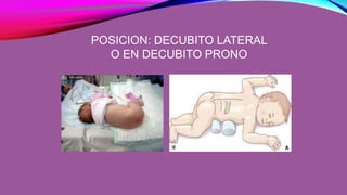 POSICION: DECUBITO LATERAL
O EN DECUBITO PRONO
 