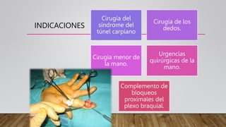 INDICACIONES
Cirugía del
síndrome del
túnel carpiano
Cirugía de los
dedos.
Cirugía menor de
la mano.
Urgencias
quirúrgicas de la
mano.
Complemento de
bloqueos
proximales del
plexo braquial.
 