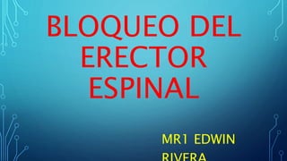 BLOQUEO DEL
ERECTOR
ESPINAL
MR1 EDWIN
 