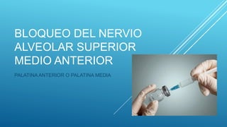 BLOQUEO DEL NERVIO
ALVEOLAR SUPERIOR
MEDIO ANTERIOR
PALATINA ANTERIOR O PALATINA MEDIA
 