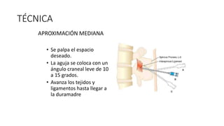 TÉCNICA
APROXIMACIÓN MEDIANA
• Se palpa el espacio
deseado.
• La aguja se coloca con un
ángulo craneal leve de 10
a 15 grados.
• Avanza los tejidos y
ligamentos hasta llegar a
la duramadre
 